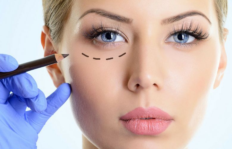 A Comprehensive Guide to Blepharoplasty Procedure