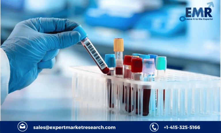 In-Vitro Diagnostics Market Size, Share, Industry Growth, Analysis, Price, Outlook, Trends And Forecast 2023-2028