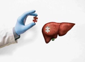 Avail The Best Treatment Of Liver Transplant In Delhi