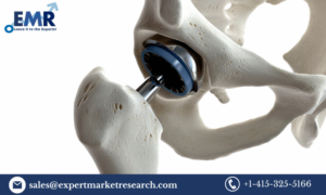 Orthopaedic Digit Implants Market