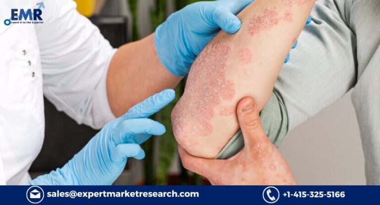 Plaque Psoriasis Treatment Market Size, Price, Trends, Growth, Report and Forecast 2023-2031
