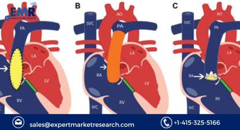 Transcatheter Pulmonary Valve Market Size, Growth 2023-2031