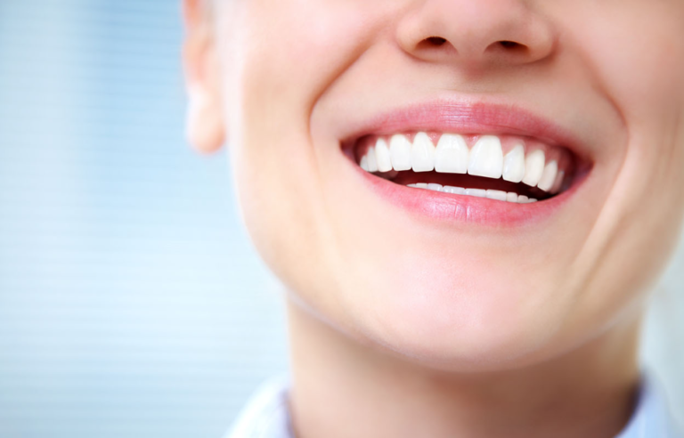 Home Remedies to Whiten Your Teeth Naturally