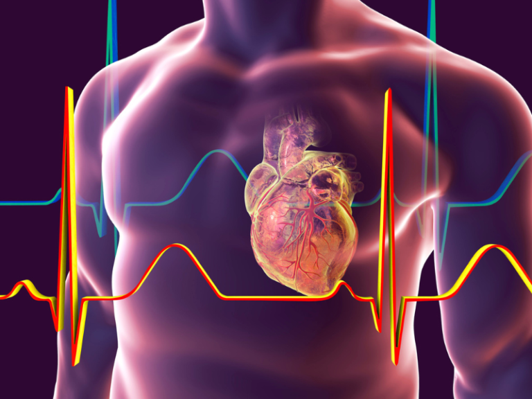 Everything to Know about ECG Test